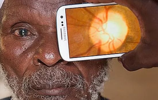 Aplicativos para Teste de Visão: Melhorando o Cuidado Ocular com Tecnologia