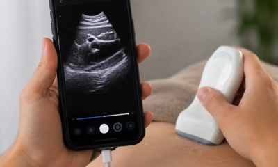 Ultrassom pelo Celular: Como Funciona