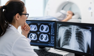 Como o raio-x digital revoluciona o diagnóstico médico moderno