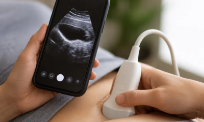Ultrassom pelo Celular: Apps e Tecnologia