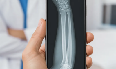Simulador de Raio X: Veja Como Funciona a Tecnologia Médica em Tempo Real