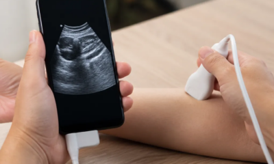 Ultrassom no Celular: Apps e Tecnologia