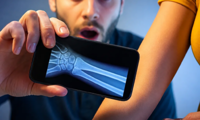 App de Raio X: Aponte a Câmera e Veja Uma Simulação Impressionante na Tela