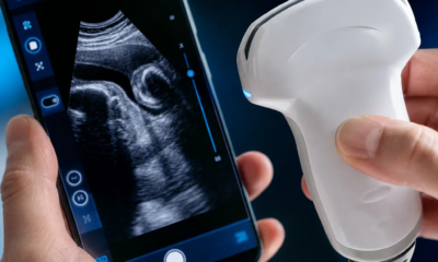 Ultrassom pelo Celular: Como Funciona