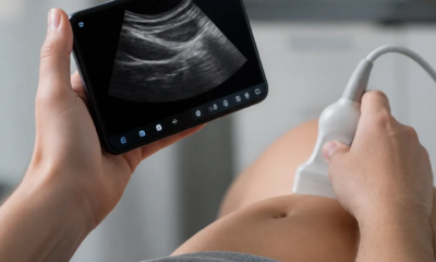 Ultrassom pelo Celular: Como Funciona