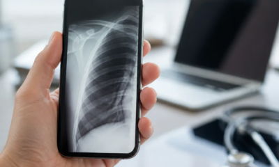 Raio x digital no seu iPhone: tecnologia de ponta ao alcance