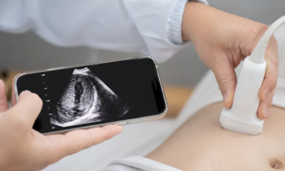 Ultrassom pelo Celular: Como Funciona